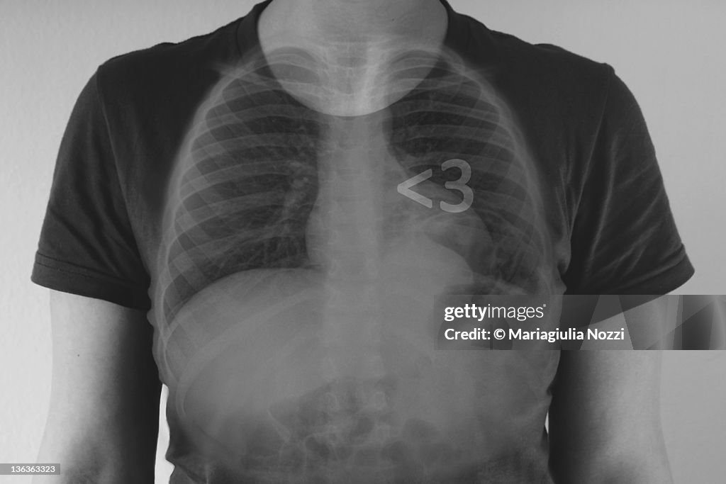 X-ray shadow on human body