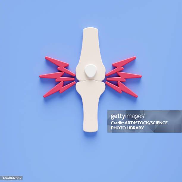 rheumatoid arthritis, conceptual illustration - pain stock illustrations