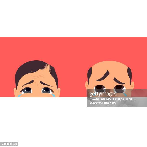 hair loss in men and women, conceptual illustration - crying stock illustrations