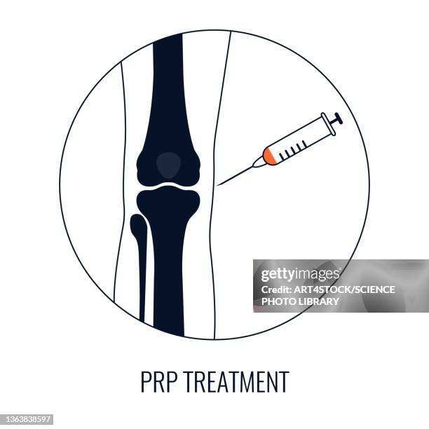 knee joint injection treatment, conceptual illustration - cell therapy stock illustrations