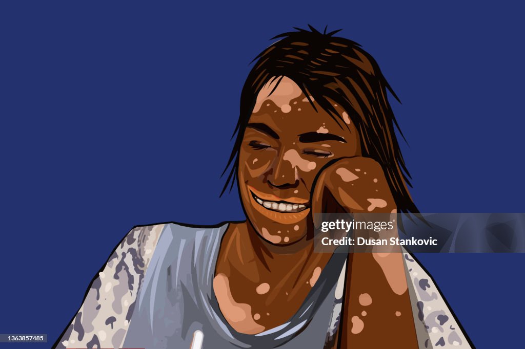 Skin condition is not a problem for me!