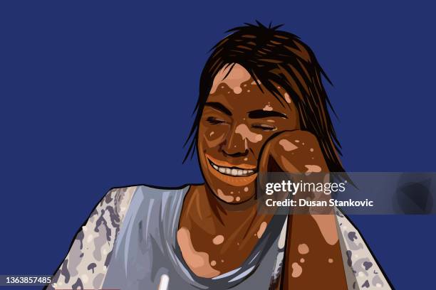 skin condition is not a problem for me! - autoimmune disease stock illustrations
