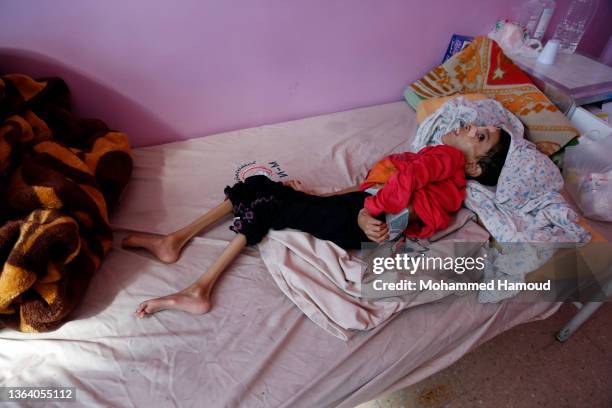 Amal Husein Al-Sufi a Yemeni malnourished girl is seen on a bed while receiving anti-malnutrition treatment at a hospital on January 11, 2022 in...