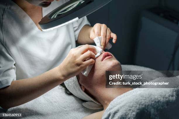 dermatologue faisant des soins du visage contre l’acné - blackheads photos et images de collection