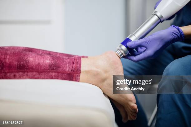 shockwave therapy for heel spur - shockwave therapy stock pictures, royalty-free photos & images