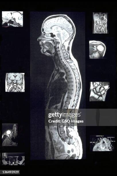 mri images of man with various sections - brain and spinal cord mri stock pictures, royalty-free photos & images