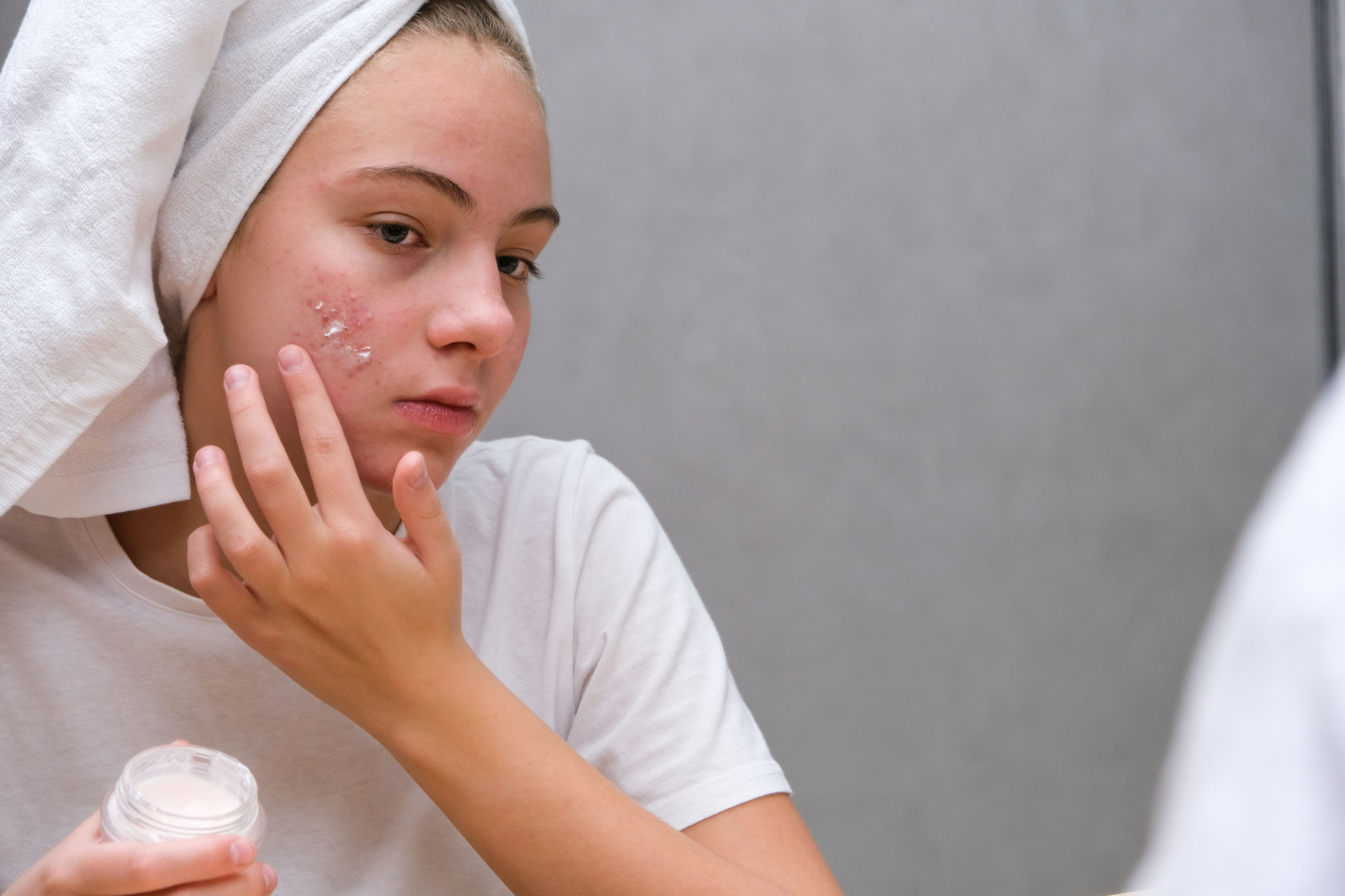 tween skincare