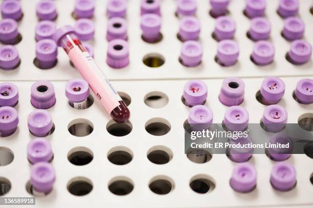 close up of blood in vials - blood collection tube stock pictures, royalty-free photos & images