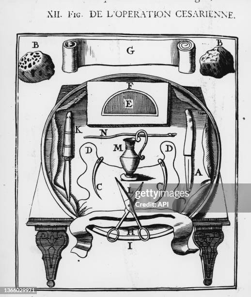 Instruments de chirurgie pour les césariennes, extrait de "Cours d'opérations de chirurgie" par Pierre Dionis en 1757.