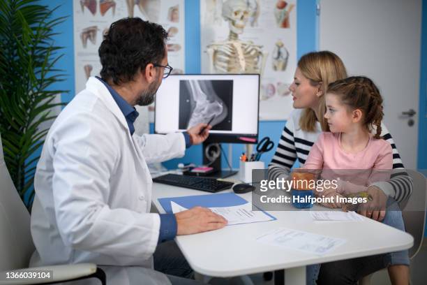 orthopedic doctor reviewing x-ray results with mother and her little daughter in clinic. - leg show 個照片及圖片檔