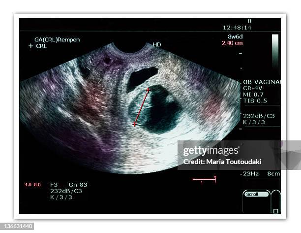 twin ultrasound - twin ultrasound stock pictures, royalty-free photos & images