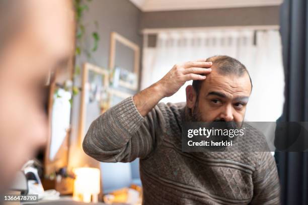 hombre revisando el cabello en el espejo - cuero cabelludo fotografías e imágenes de stock