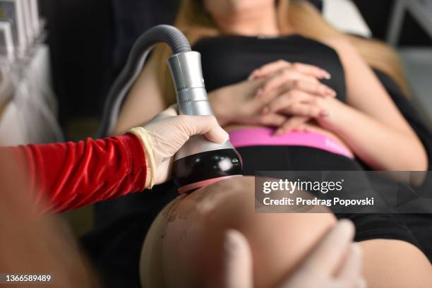 rf treatment in beauty salon - liposuction stock pictures, royalty-free photos & images