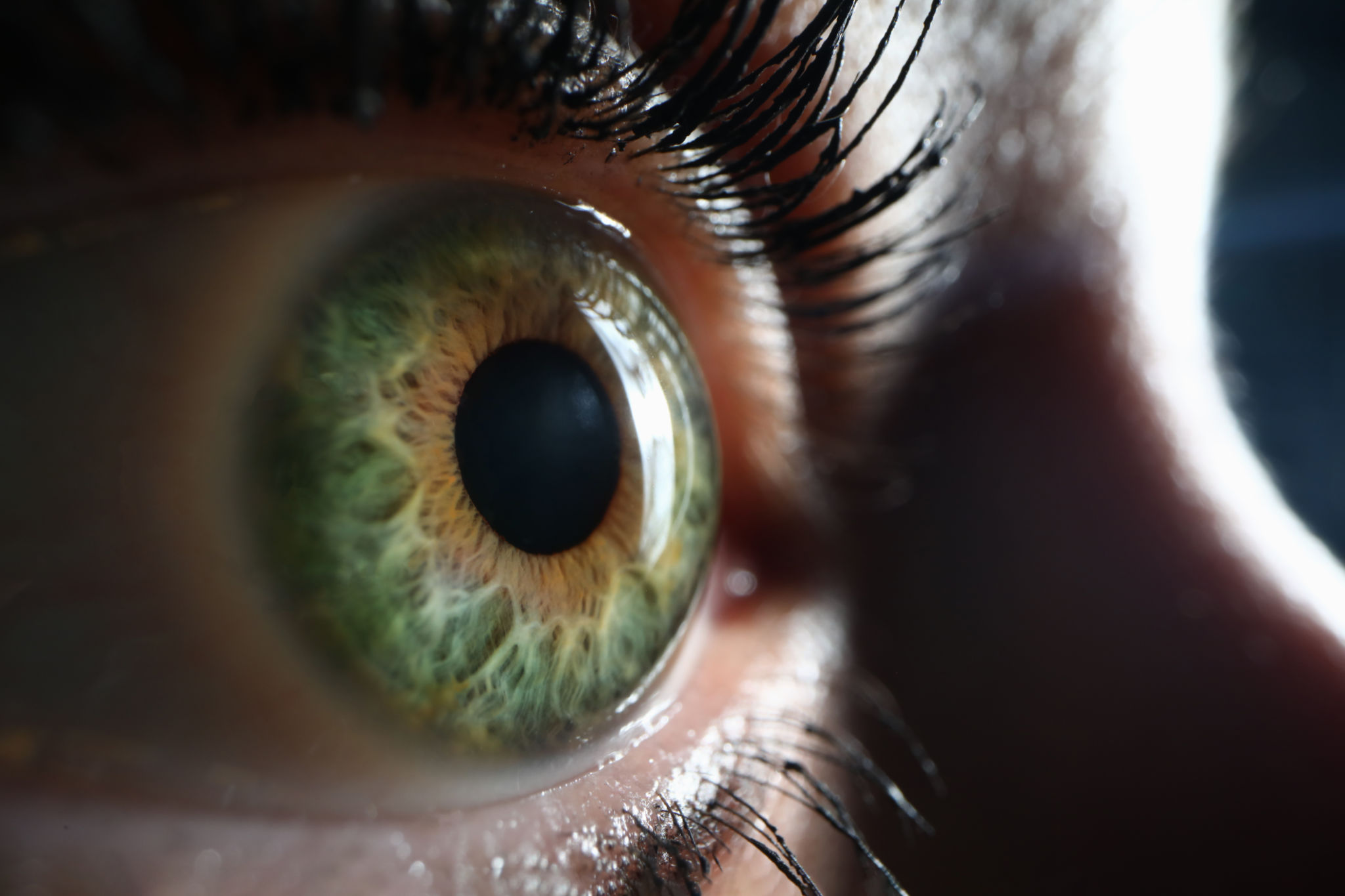 iridology eye
