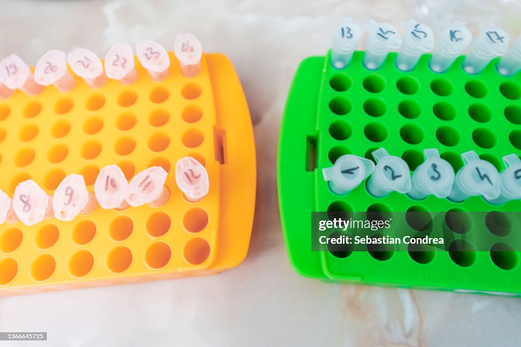 Science test pipette plastic tips tube, research and testing of the new coronavirus variant, omicron.