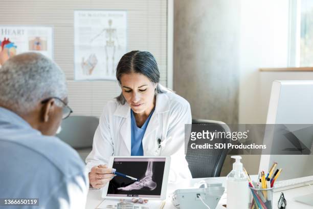 orthopäde bespricht fußröntgen des älteren patienten - orthopädie stock-fotos und bilder