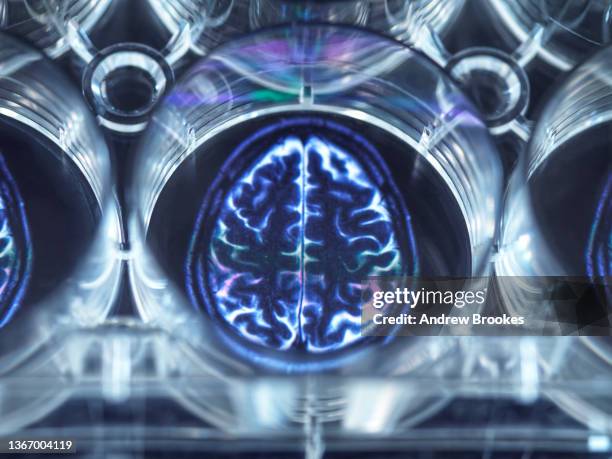 pipetting potential cure for brain disorders into a multi well plate - human brain mri stock pictures, royalty-free photos & images
