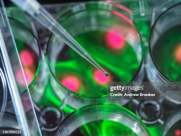 pipetting sample into multi well plate containing micrograph of cell - bone marrow transplant foto e immagini stock