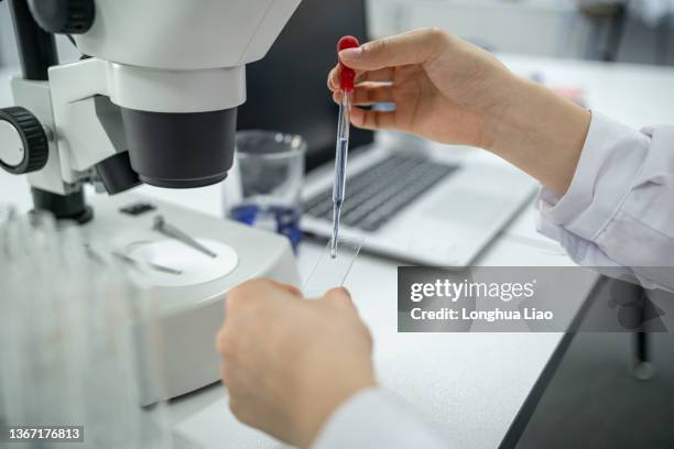 Path Lab Slides Pathology Lab Slide Photos and Premium High Res Pictures - Getty Images