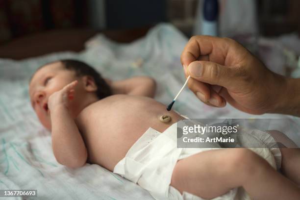 father cleaning his baby's navel with cotton swab - umbilical cord 個照片及圖片檔