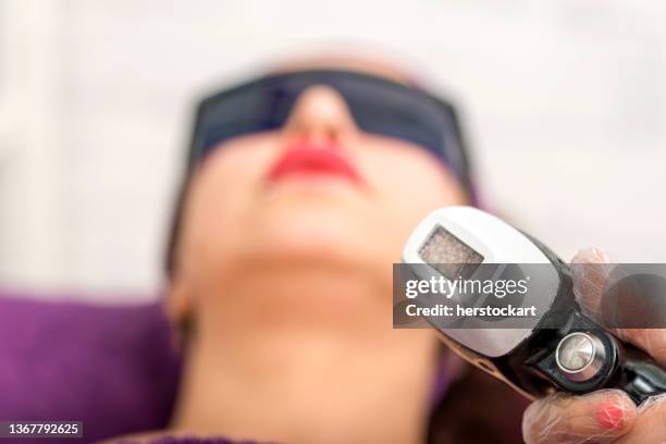 ice laser hair removal - laser surgery stock pictures, royalty-free photos & images