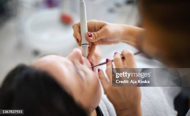 dentist removing dental calculus. - dental calculus stock pictures, royalty-free photos & images