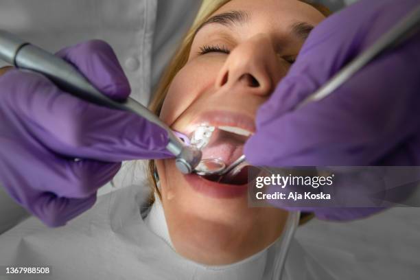 zahnarzt, der die zähne des patienten in der zahnarztpraxis repariert. - zahnbohrer stock-fotos und bilder
