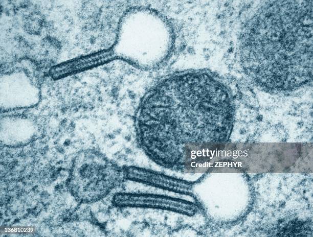 langerhans cell, tem - elektronenmikroskop stock-fotos und bilder