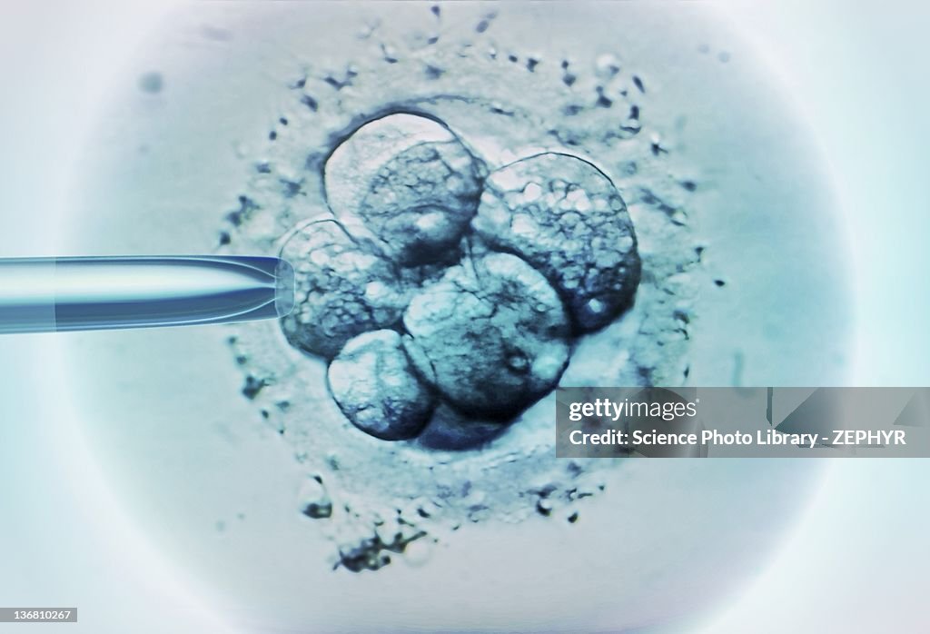 Embryo selection for IVF light micrograph