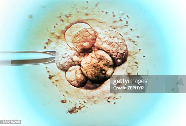 embryo selection for ivf light micrograph - fertilização in vitro imagens e fotografias de stock