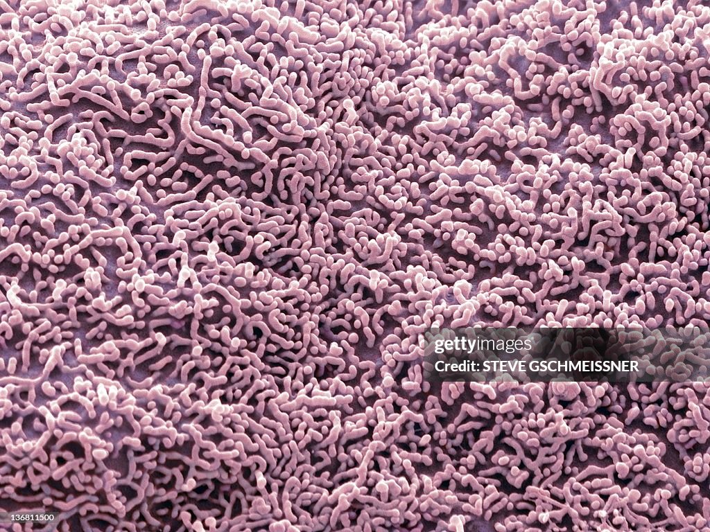 Ureter lining, SEM
