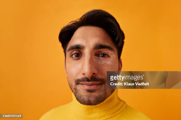 young man with vitiligo against yellow background - mustache stock pictures, royalty-free photos & images