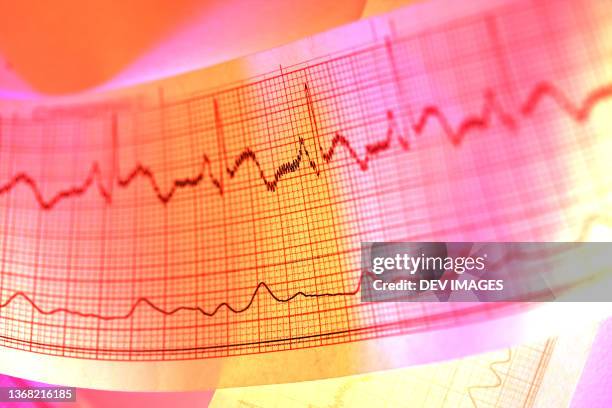 close up of electrocardiogram - heartbeat stock-fotos und bilder