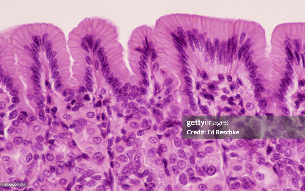 Stomach Mucosa With Simple Columnar Epithelium 50x High-Res Stock Photo ...