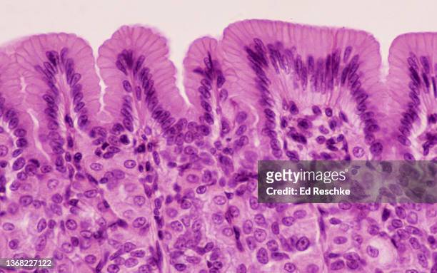 stomach mucosa with simple columnar epithelium, 50x - simple columnar epithelial cell stock pictures, royalty-free photos & images