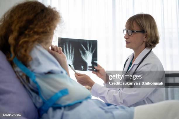 doctor holding an x-ray film of patients hand bones and talking to patients while sitting on bed in hospital. - rheumatism stock pictures, royalty-free photos & images
