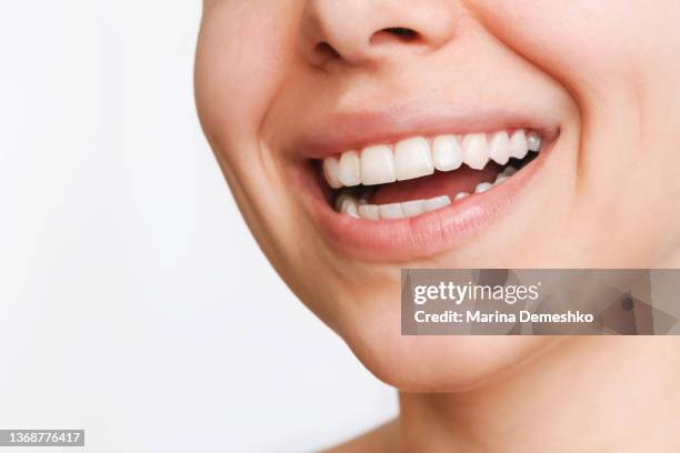 Close-up of beautiful smile. Cropped shot of a young caucasian woman with perfect white even teeth