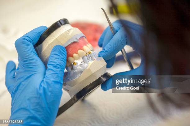 dental technician working on a jaw model - dental crown stock pictures, royalty-free photos & images