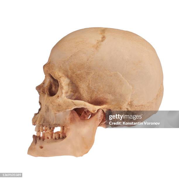 human skull with bad teeth side view. isolated on white background - skull stock pictures, royalty-free photos & images