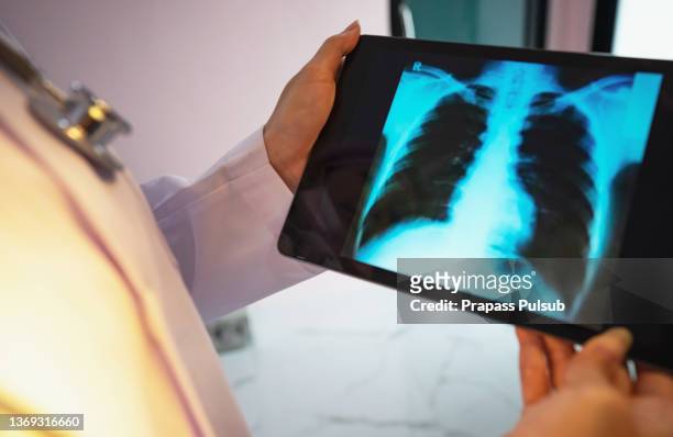 doctor checking chest x-ray film at ward hospital. - costela osso humano - fotografias e filmes do acervo