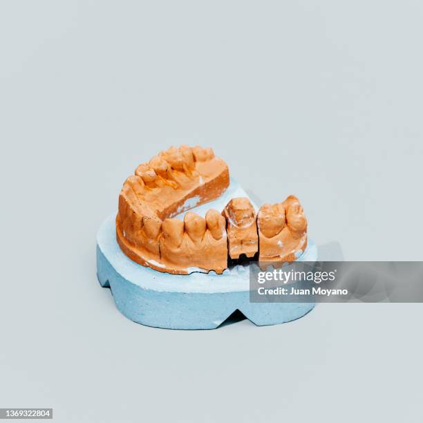 dental mold on a gray background - molde dental fotografías e imágenes de stock