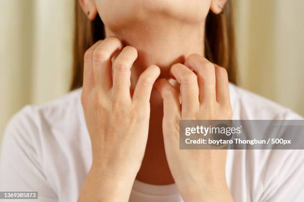 woman suffers from itchy,irritated skin due to covid-19 - skin cross section stock pictures, royalty-free photos & images