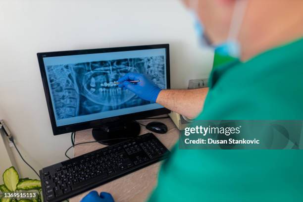 observing cavities and other teeth problems of a patient - human jaw bone stock pictures, royalty-free photos & images