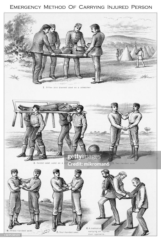 Emergency Method Old Engraved Illustration Of Emergency Method Of Carrying Injured ...
