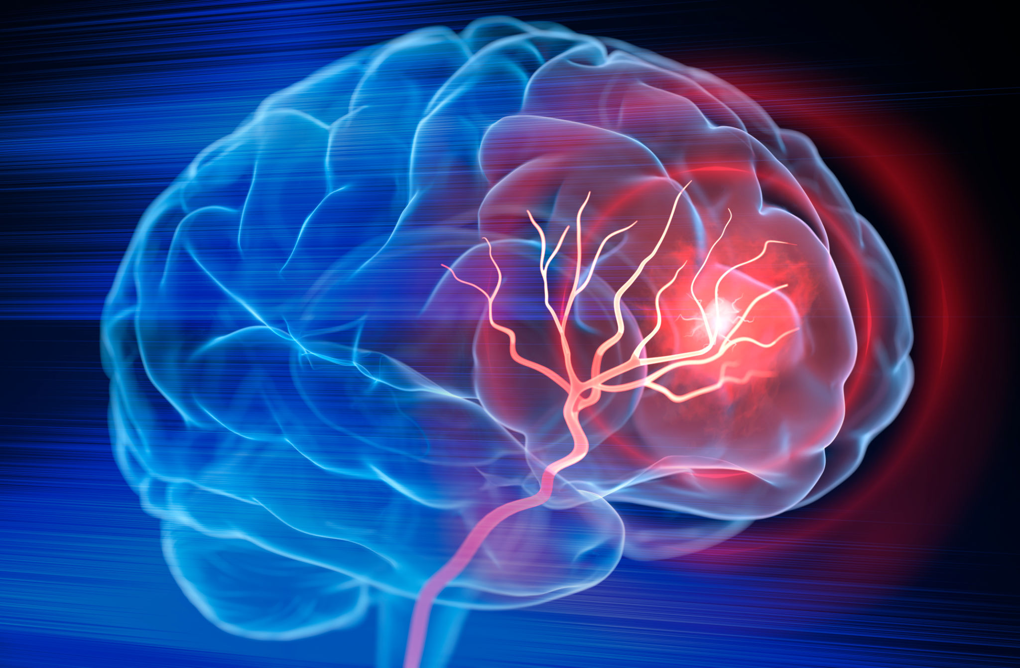 brain health consultation