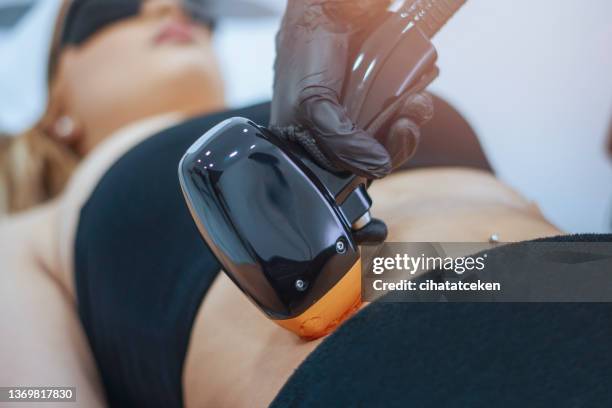 laser hair removing epilation on hands - hair removal stock pictures, royalty-free photos & images