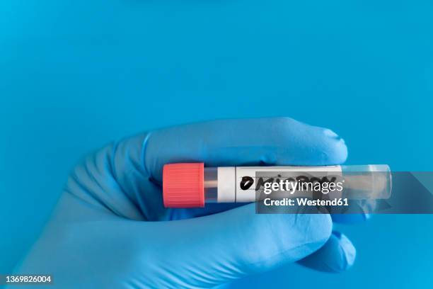 medical expert holding swab tube against blue background - omicron photos et images de collection