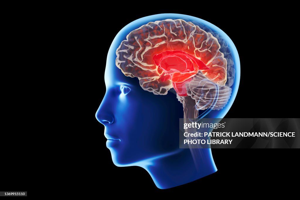 Alzheimer's disease affecting the hippocampus, illustration