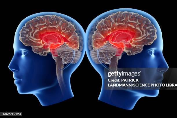 alzheimer's disease affecting the hippocampus, illustration - microglia stock illustrations