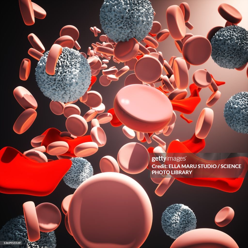 Thalassemia, illustration